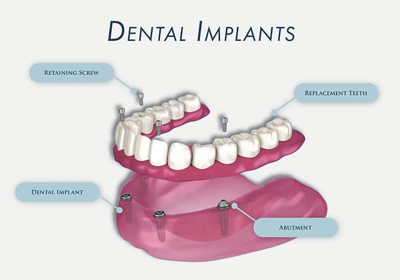 Cary Family Dental in Cary