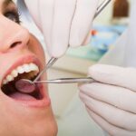 mouth cancer symptoms, oral cancer signs, dental screenings, Cary Family Dental, Dr. Niraj Patel, Cary IL dentist, oral cancer screening, dentist Cary, dentist in Cary