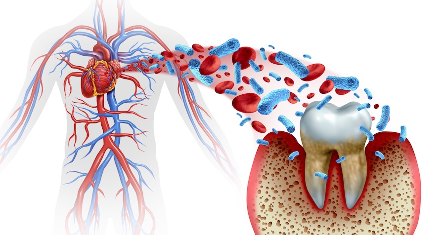 oral health and heart health connection, gum disease