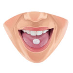 patient taking pill for oral conscious sedation a form of dental sedation for dental anxiety