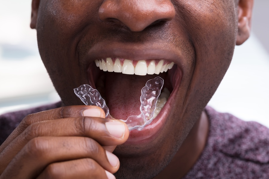 TMJ pain and invisalign clear aligner treatment