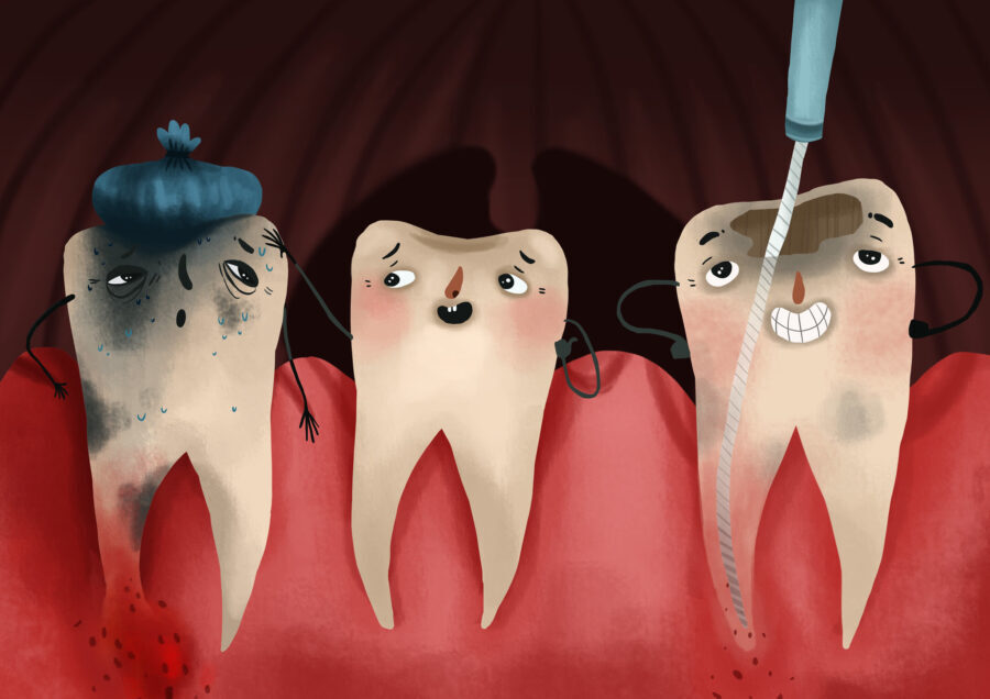 tooth getting a root canal, prevent needing a root canal, toothache