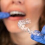 woman with invisalign clear aligner tray for invisalign timeline