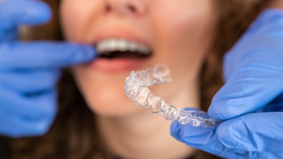 woman with invisalign clear aligner tray for invisalign timeline
