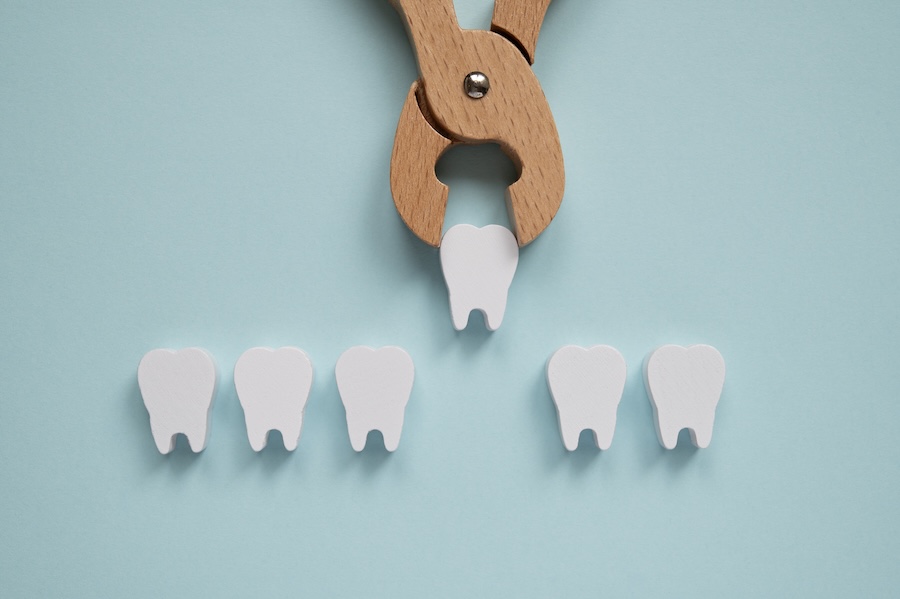 wooden model of a tooth extraction, dental extraction, oral surgery