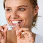 teeth whitening