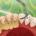 dental plaque, dental calculus, tartar, bacteria, removal during cleaning