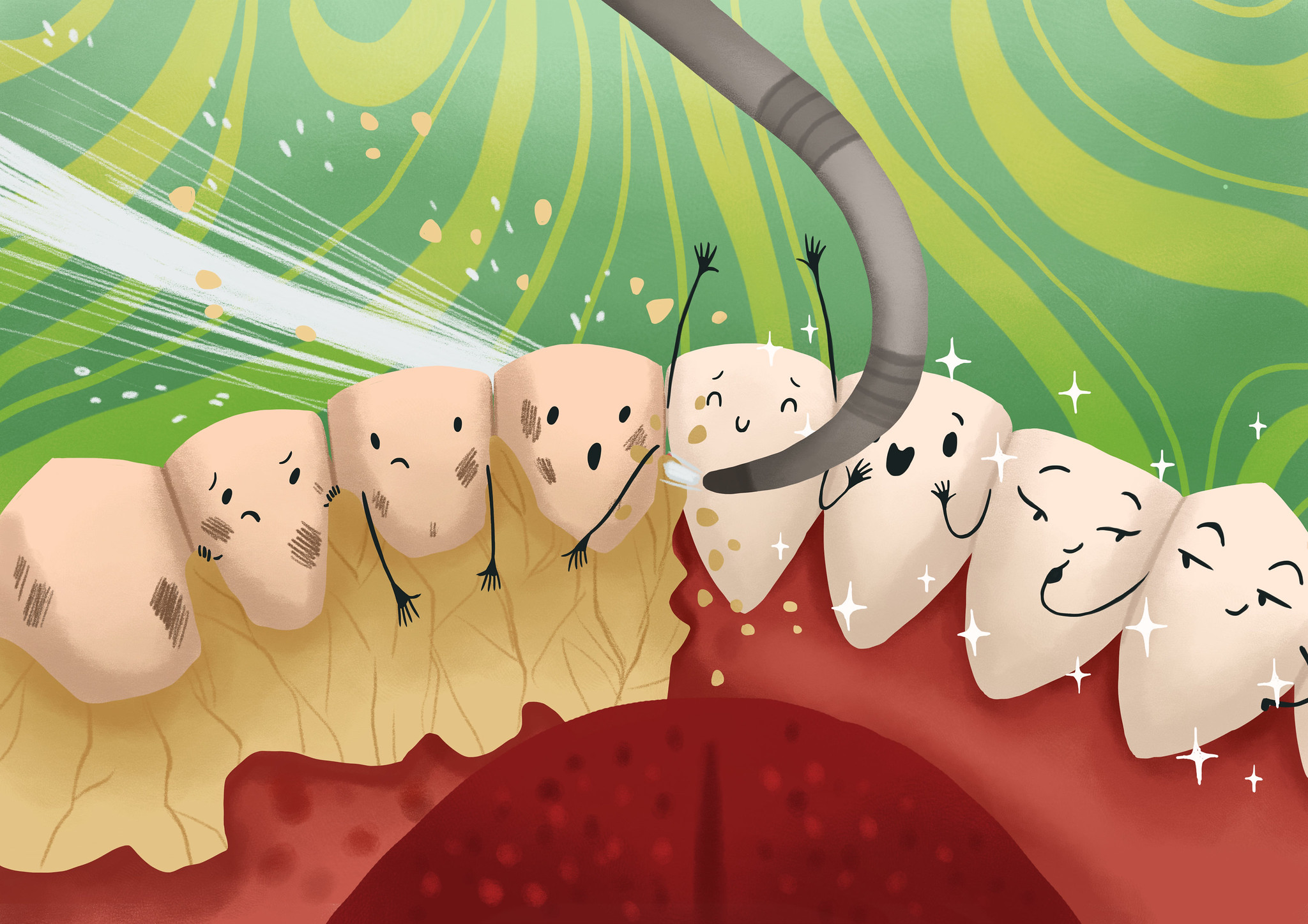 dental plaque, dental calculus, tartar, bacteria, removal during cleaning